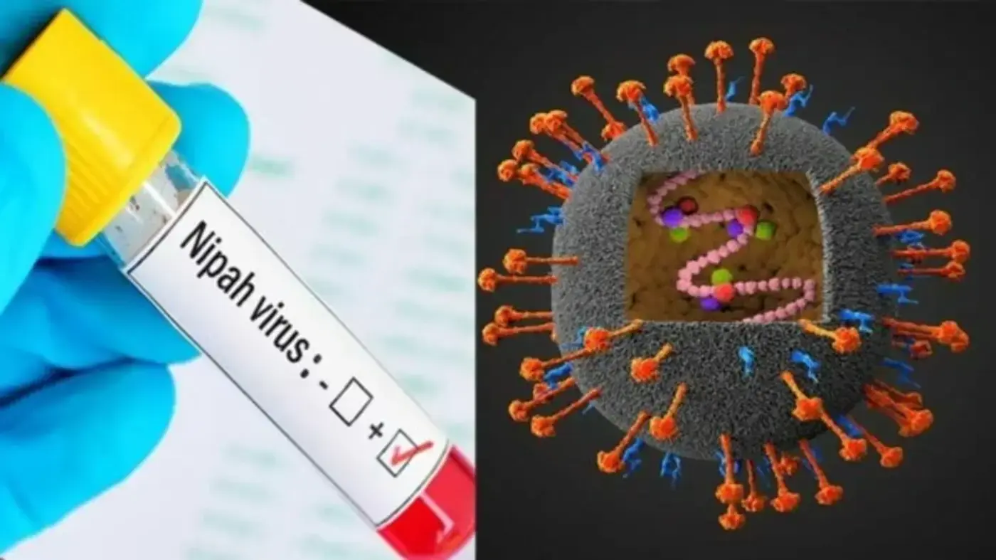 निपाह वायरस संक्रमण क्या है और इसकी रोकथाम?